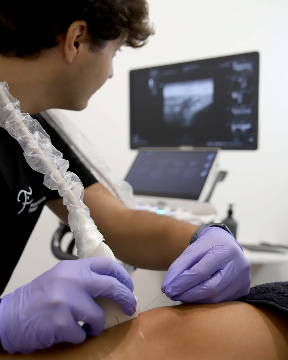 Técnica ecoguiada en Fisioterapia TEMBO